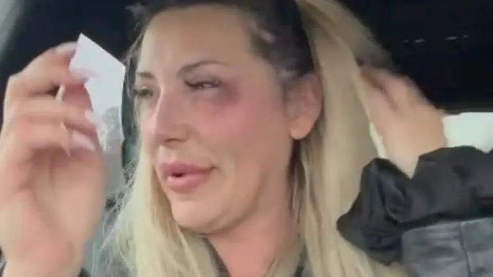 Pjevačica Monika Ivkić tvrdi da je pretučena u Njemačkoj: “Gazdarica kluba me prebila”