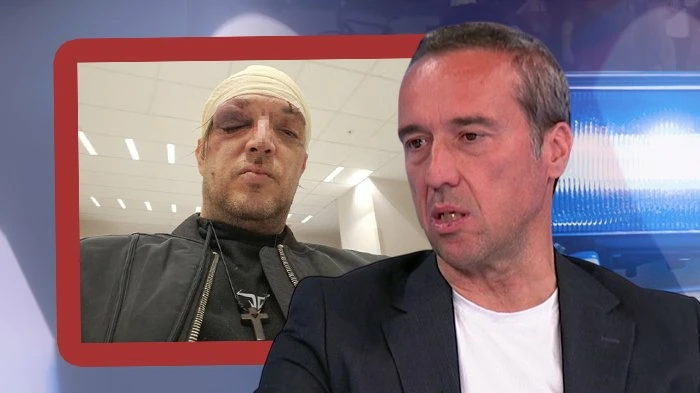 Mijatović otkrio detalje napada na Zorana Marjanovića: Ne žele da sarađuju s policijom