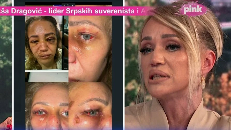 Uhapšen osumnjičeni za nasilje nad influenserkom Kikom Živković: Uhapšen mjesec dana nakon objave snimka, traži se pritvor