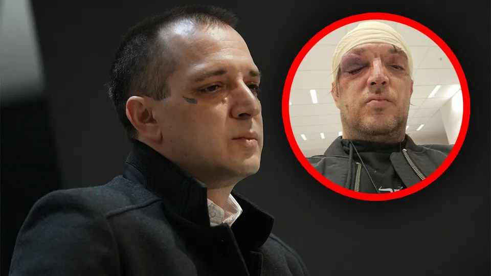 Povrijeđen Zoran Marjanović: Mediji pišu o kontuziji mozga, tvrdi se da su mu izbijeni zubi