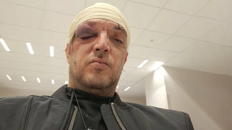 Kompozitor Zoran Marjanović progovorio o napadu: "Ovo je moje posljednje oglašavanje na ovu temu"